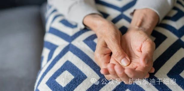 干細(xì)胞治療帕金森病