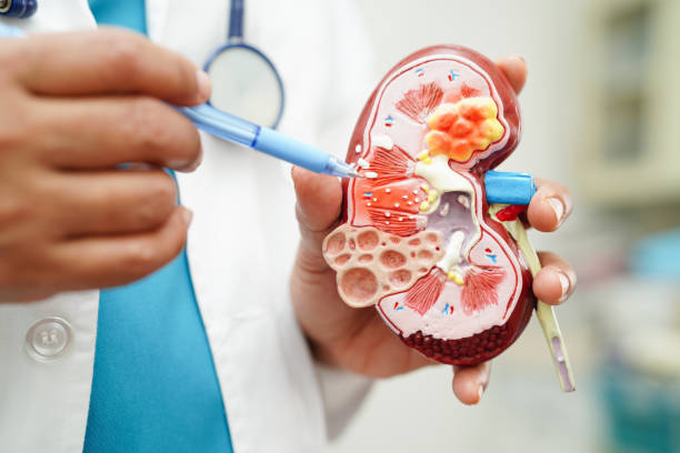 4種診斷慢性腎病方法，你知道幾種？